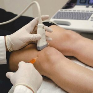 Osocze bogatopłytkowe PRP w ortopedii – zastosowanie i zalety